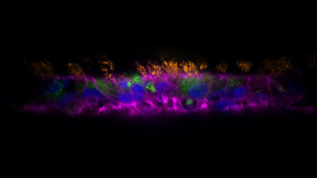 Human airway epithelial cells after growth and differentiation inside an AirGel tissue-engineered airway. Green: mucus; orange: cilia; pink: actin; blue: nuclei - 2023 EPFL/Tamara Rossy - CC-BY-SA 4.0