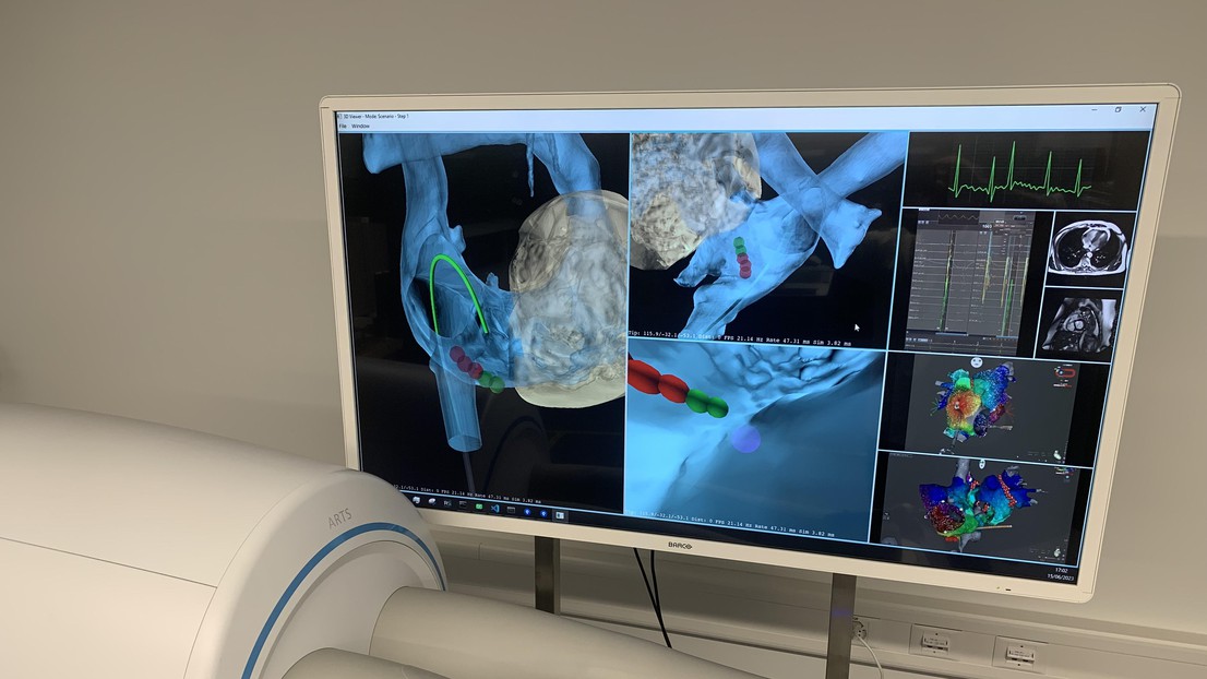 Cardiac intervention simulator © EPFL 2023