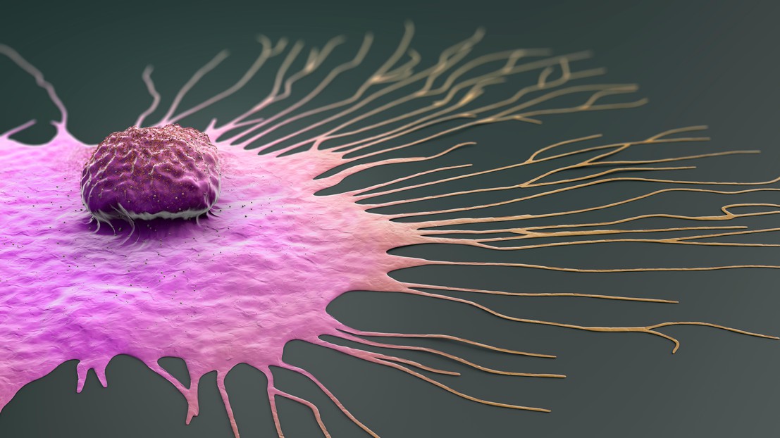 A migrating breast cancer cell © EPFL/iStock photos (Christoph Burgstedt)