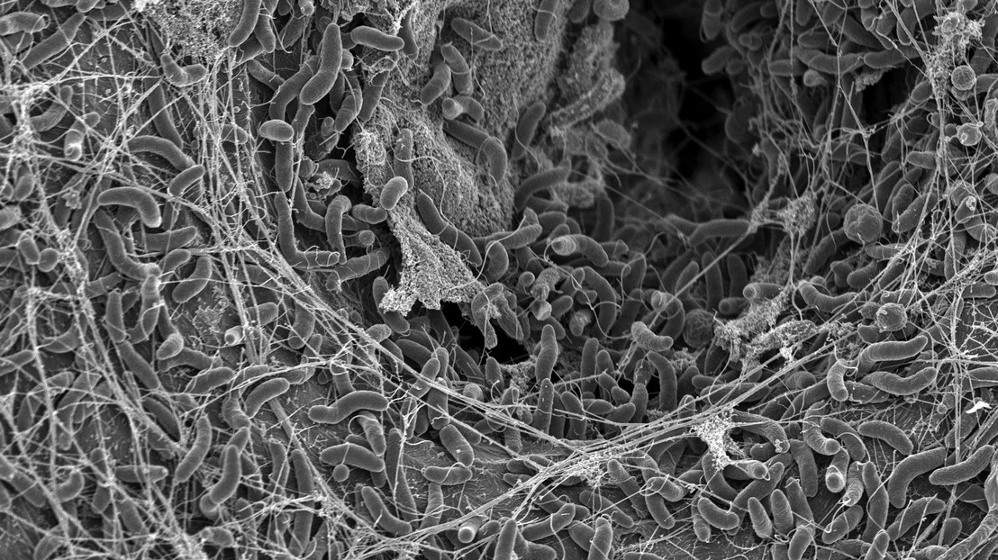 Vibrio cholerae bacteria, photo taken with a Scanning Electron Microscope. 2025 EPFL/Graham Knott et Melanie Blokesch - CC-BY-SA 4.0