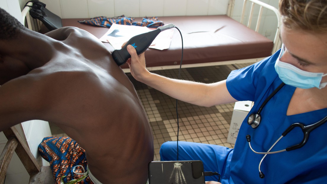 Dr. Véronique Suttels performs a smartphone-connected ultrasound on a symptomatic Beninese patient - 2025 EPFL/Véronique Suttels - CC-BY-SA 4.0 Dr. Véronique Suttels performs a smartphone-connected ultrasound on a symptomatic Beninese patient - 2025 EPFL/Véronique Suttels - CC-BY-SA 4.0