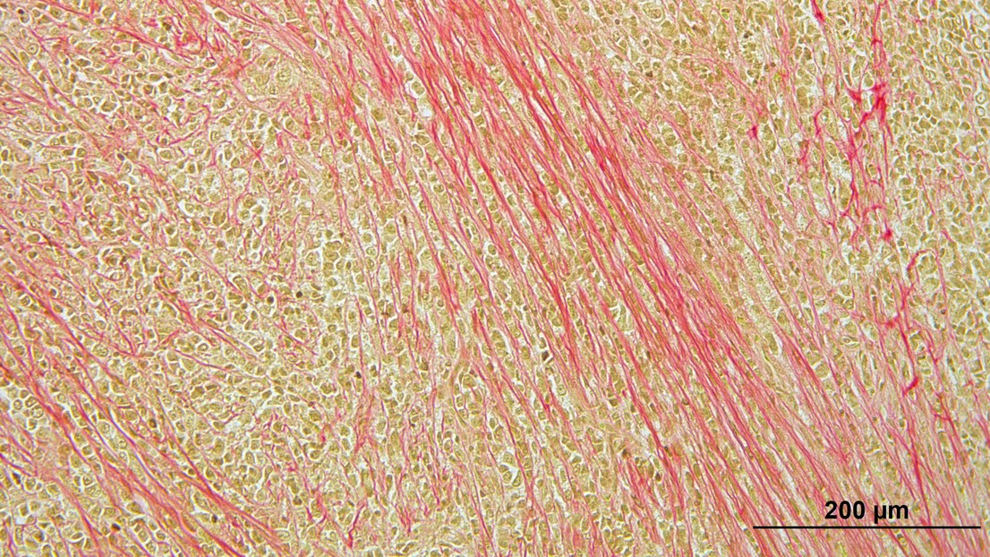 A laboratory preclinical model of the most common special histological subtype of breast cancer. Courtesy of George Sflomos (EPFL)