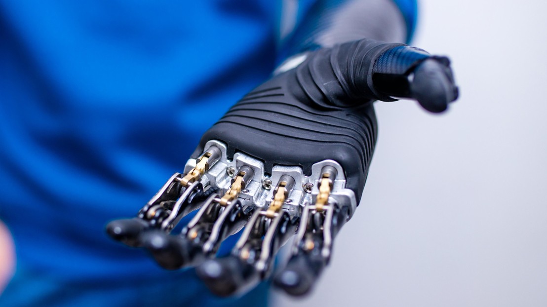 A modern prosthetic hand © iStock