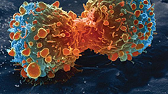 Cancer cell division / creative commons www.nih.gov Cancer cell division / creative commons www.nih.gov