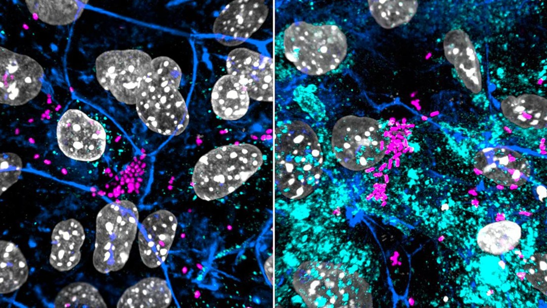 Left: Control ; Right: Uro-Vaxom® (OM-89) - 2026 EPFL- Kathrin Tomasek- CC-BY-SA 4.0