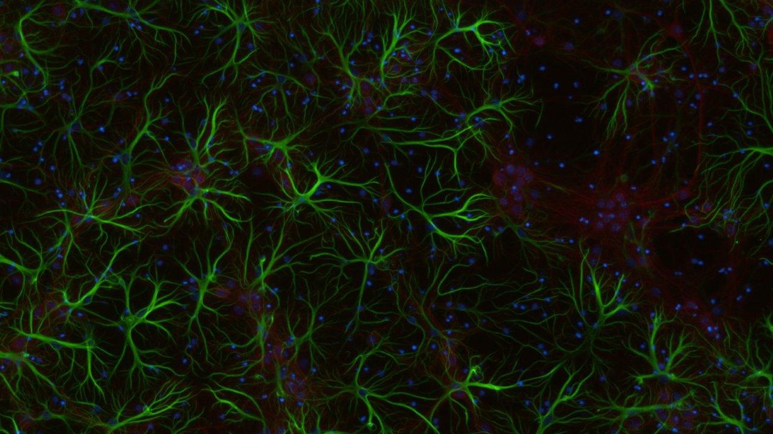 Astrocytes in the brains