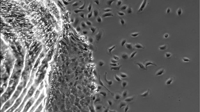 Cells migrating off a fish scale © 2014 EPFL Cells migrating off a fish scale © 2014 EPFL