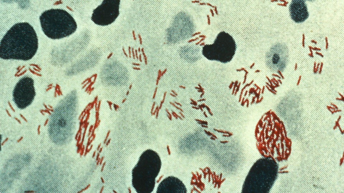 Mycobacterium leprae (red) © CDC Mycobacterium leprae (red) © CDC
