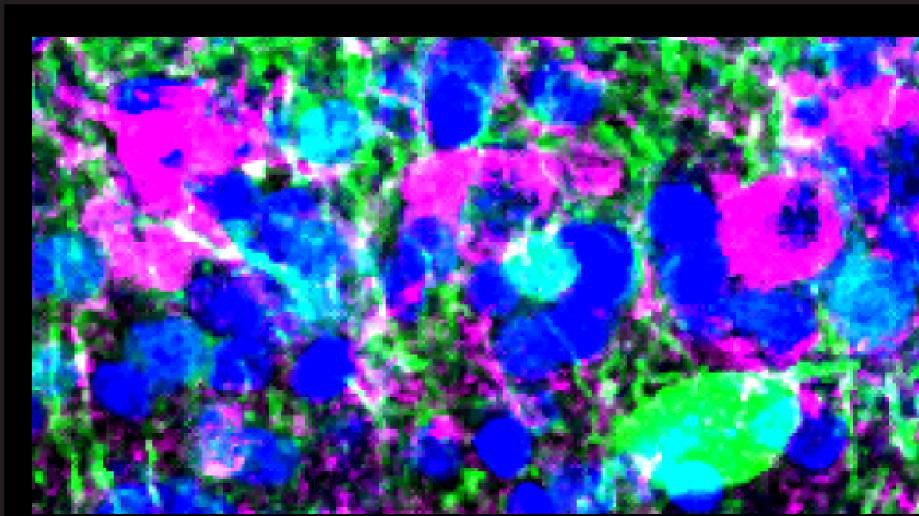 © 2015 UNIGE © 2015 UNIGE