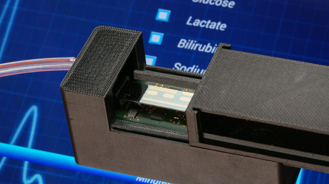 The biosensor and the app aimed at monitoring the results in real-time. © Alain Herzog / EPFL 2015 The biosensor and the app aimed at monitoring the results in real-time. © Alain Herzog / EPFL 2015