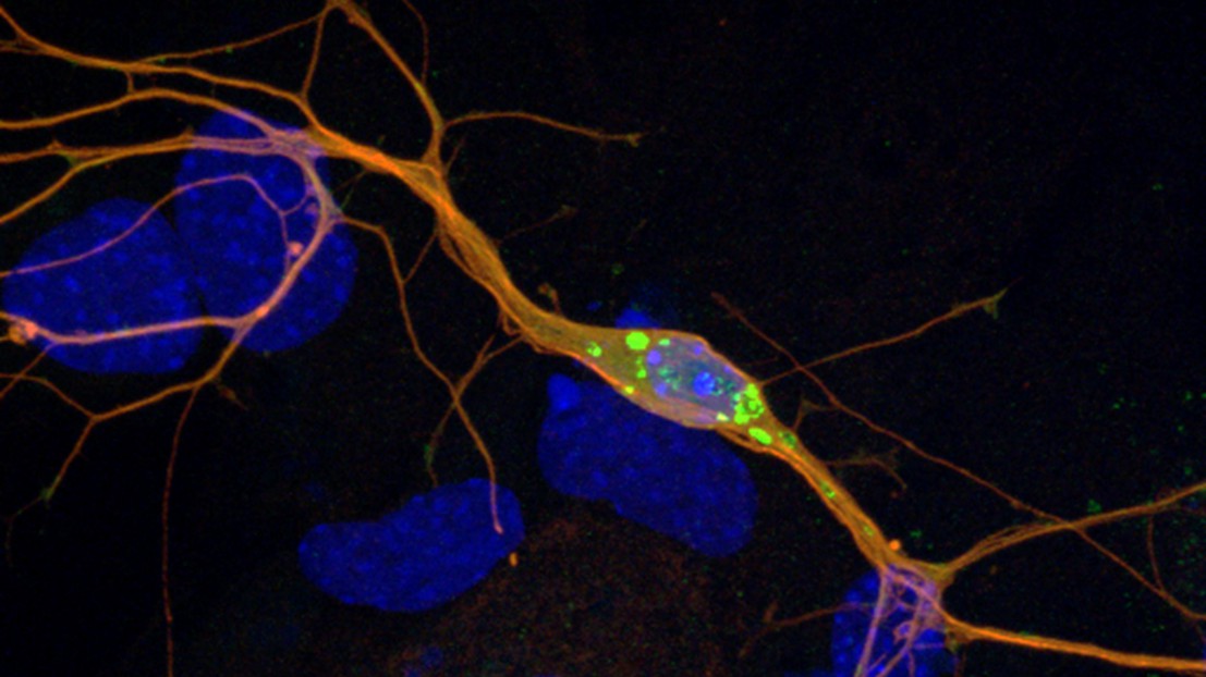 A mouse neuron with Lewy bodies (green) © M. Fares (EPFL) A mouse neuron with Lewy bodies (green) © M. Fares (EPFL)