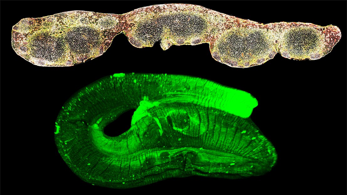 Lymph node follicles (top) and the intestinal worm Heligmosomoides polygyrus bakeri (bottom) © N. Harris (EPFL) Lymph node follicles (top) and the intestinal worm Heligmosomoides polygyrus bakeri (bottom) © N. Harris (EPFL)