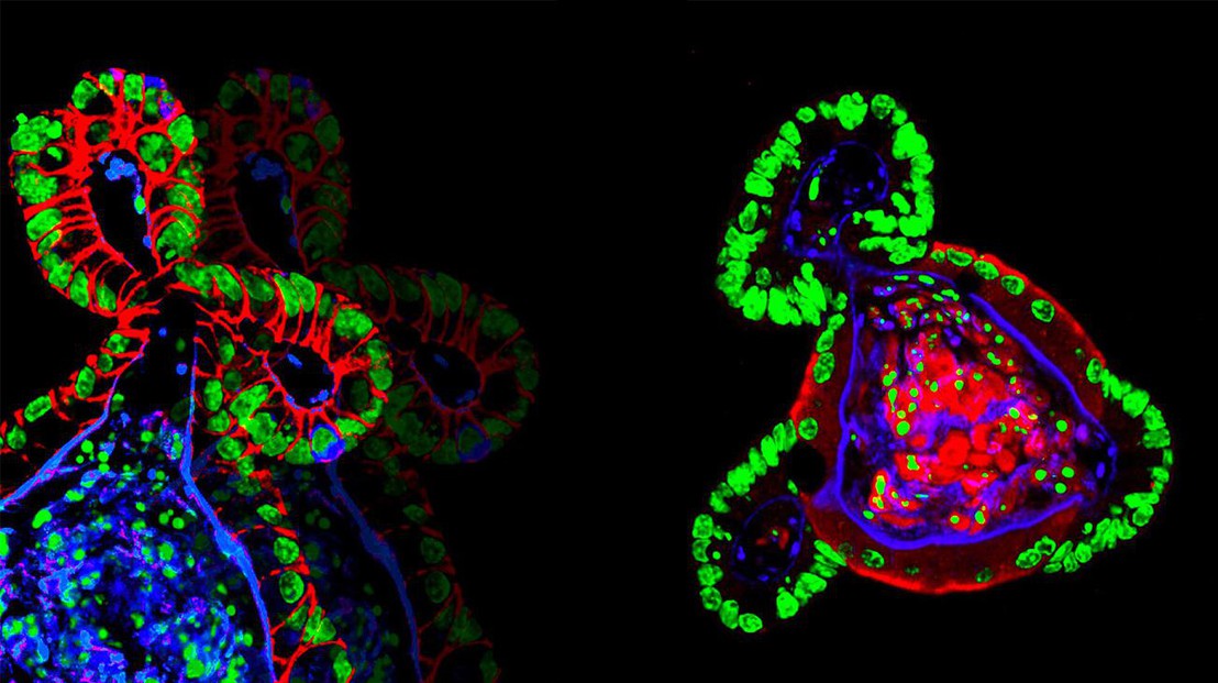 Intestinal organoids grown in synthetic hydrogels © N. Gjorevski/EPFL Intestinal organoids grown in synthetic hydrogels © N. Gjorevski/EPFL