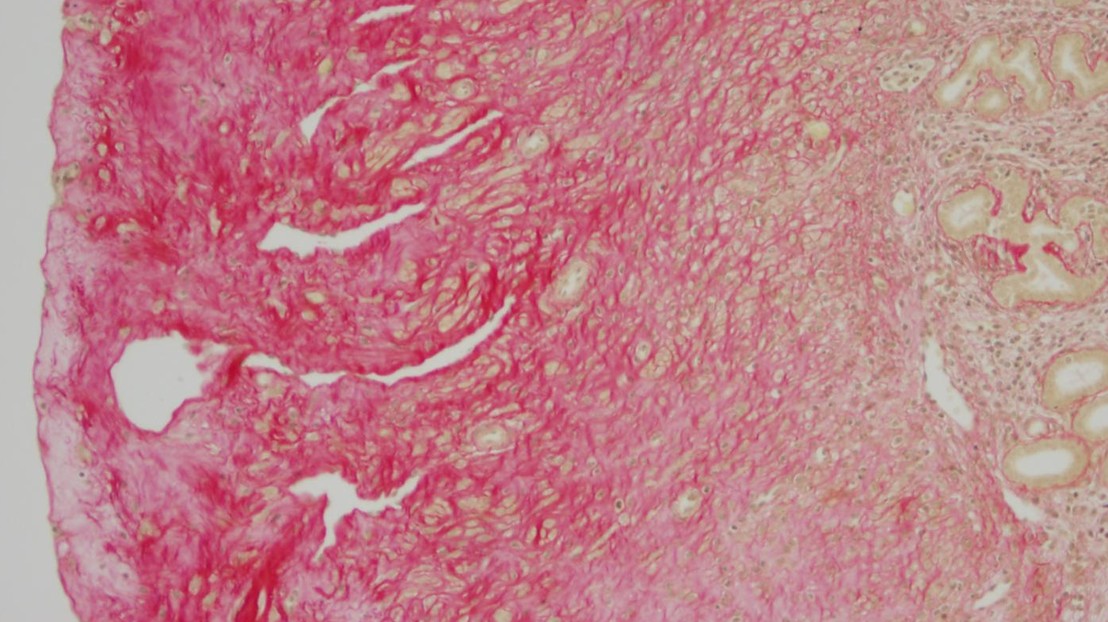 Accumulation of extracellular material in mice uterus. © EPFL Accumulation of extracellular material in mice uterus. © EPFL