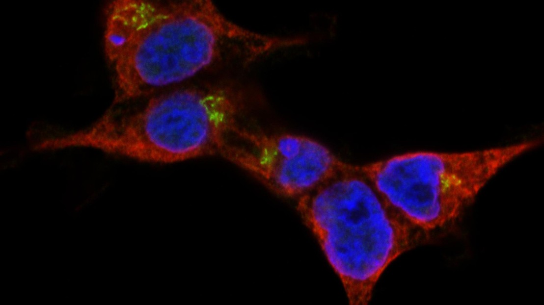 STING (green), a membrane protein located on the endoplasmic reticulum (red), rearranges upon activation and triggers cell type-specific death response. Credit: Simone Haag/A. Ablasser/EPFL