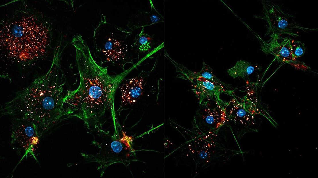 Two images of EVIR-engineered dendritic cells (green) capturing tumor antigens in exosomes (gold/red). Cell nuclei are colored blue. Credit: C. Cianciaruso/M. De Palma/EPFL