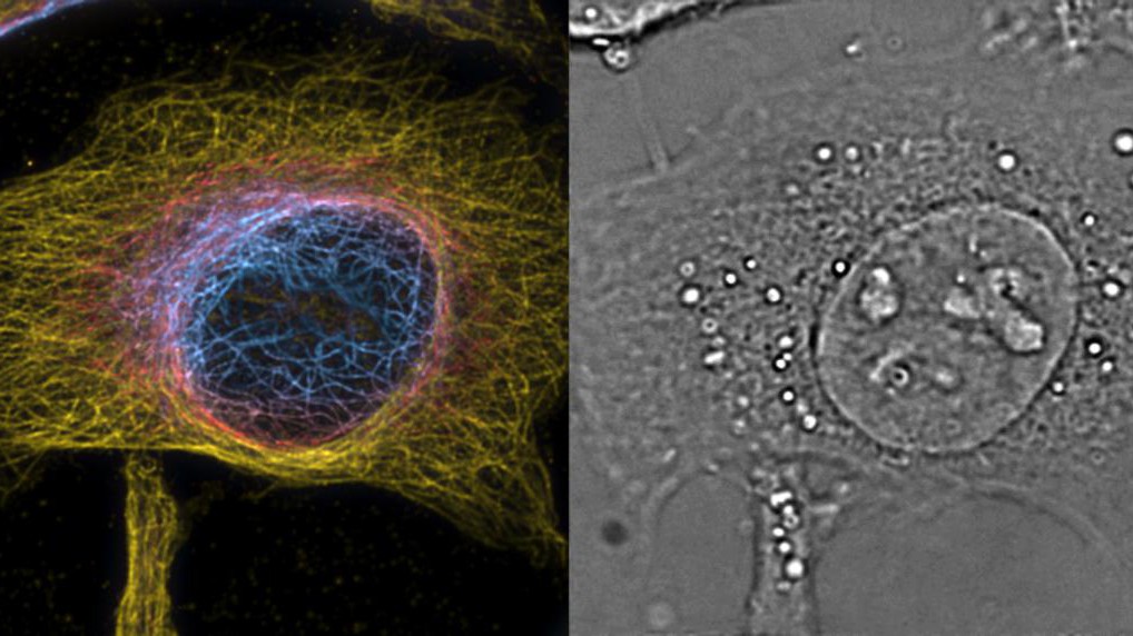 A cell visualized with the PRISM method © T. Lasser/EPFL