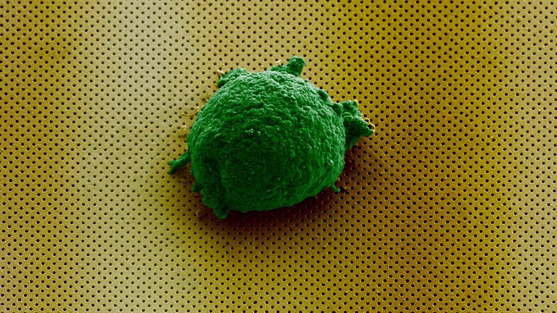 Microscopic image of a single cell artificially colored, laying on billions of nanoholes© Cover image of the forthcoming edition of Small / 2018 EPFL Microscopic image of a single cell artificially colored, laying on billions of nanoholes© Cover image of the forthcoming edition of Small / 2018 EPFL
